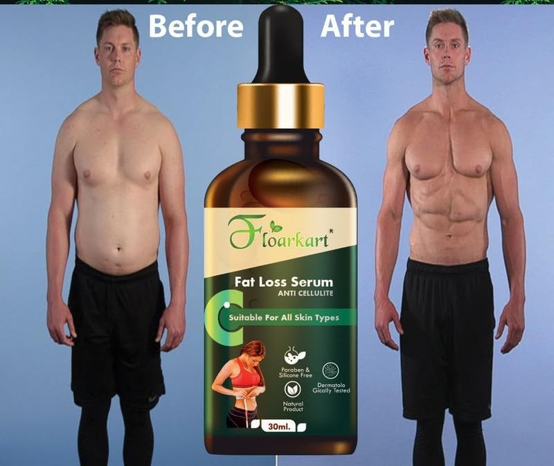 natural herbs Fat Loss Serum Anti Cellulite & Stomach all skin type 30ml