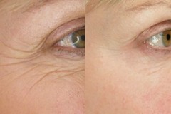 Antiaging Antioxidant supplement – ANTI PARASITE – ANTI WRINKLE COMBO – coenzyme